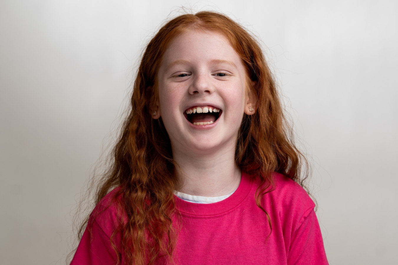 Smiling child demonstrating facial changes with orthodontic treatment.