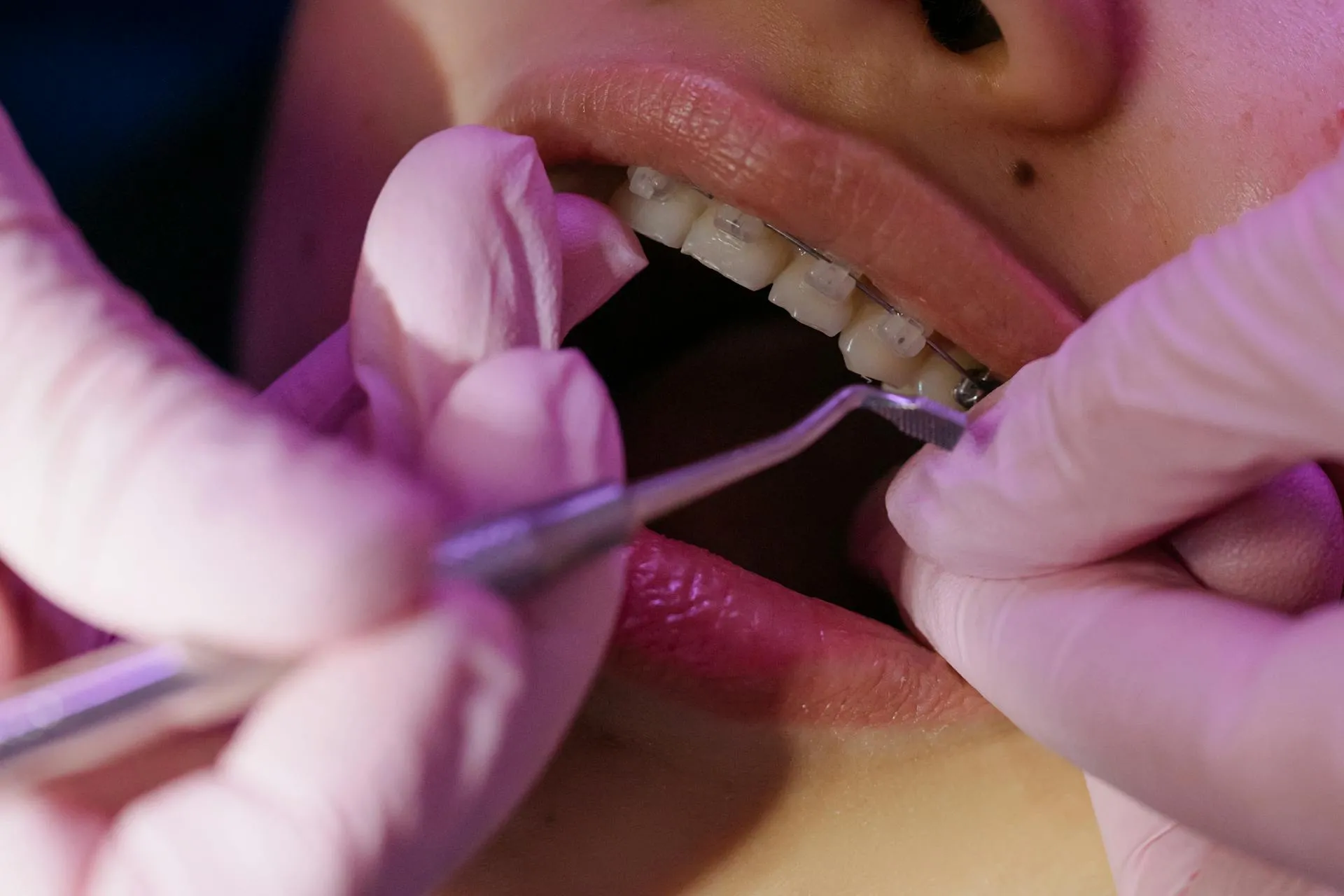 how orthodontics improves speech and pronunciation
